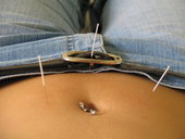 Acupuncture points on the abdomen are used to treat digestive complaints.