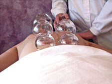 Cupping on the back can be used to relieve muscle pain or to ward off the onset of a cold.  Despite the strange way it looks, cupping feels good and is deeply relaxing.