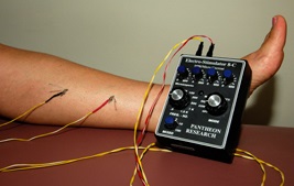 Electroacupuncture is being used on a patient's leg.  The stimulation should not be painful.